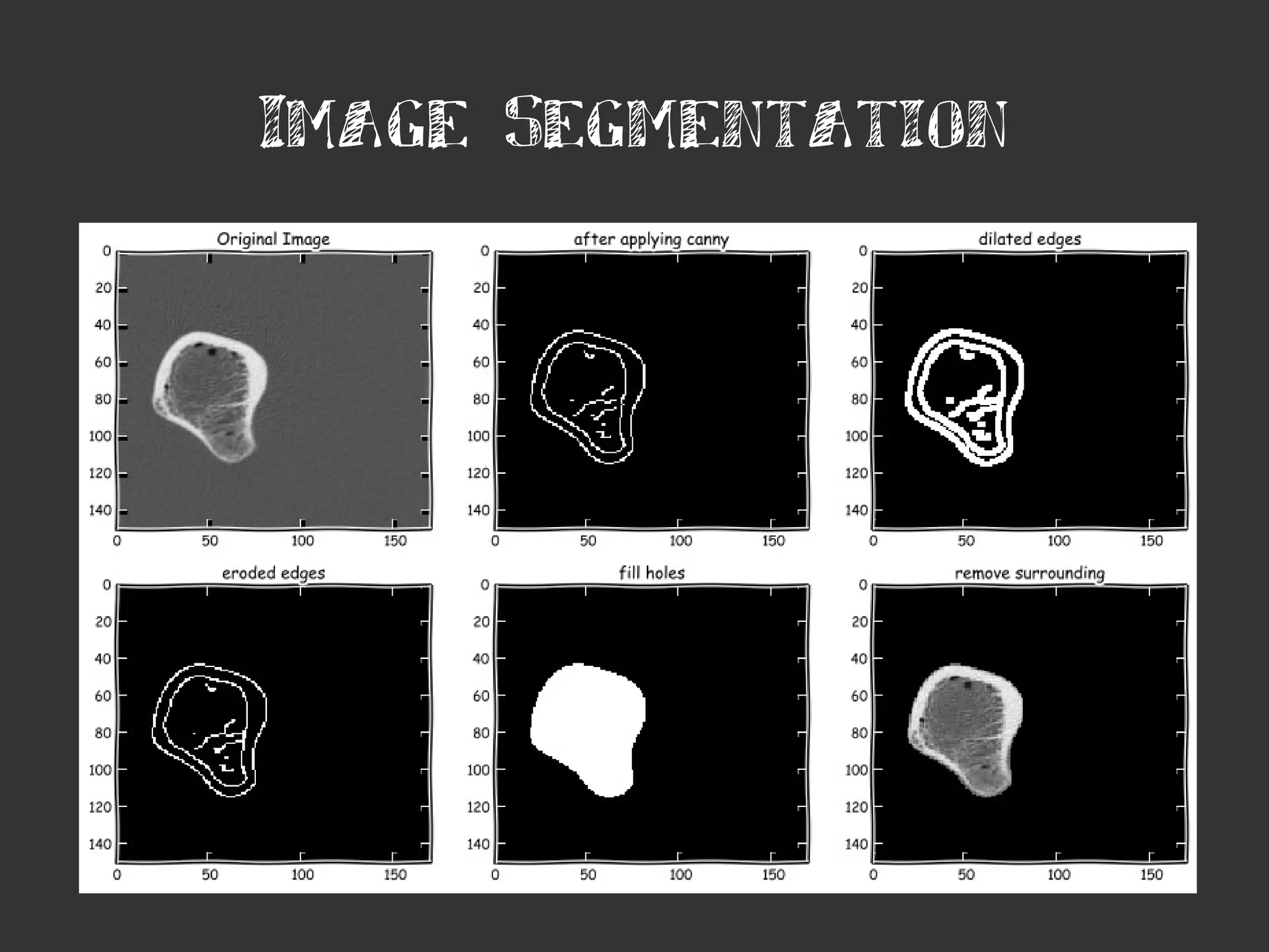 Image Segmentation
 
