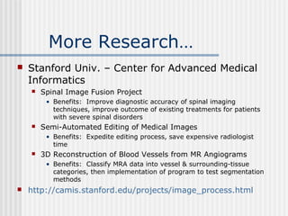 More Research…
 Stanford Univ. – Center for Advanced Medical
Informatics
 Spinal Image Fusion Project
• Benefits: Improve diagnostic accuracy of spinal imaging
techniques, improve outcome of existing treatments for patients
with severe spinal disorders
 Semi-Automated Editing of Medical Images
• Benefits: Expedite editing process, save expensive radiologist
time
 3D Reconstruction of Blood Vessels from MR Angiograms
• Benefits: Classify MRA data into vessel & surrounding-tissue
categories, then implementation of program to test segmentation
methods
 http://camis.stanford.edu/projects/image_process.html
 