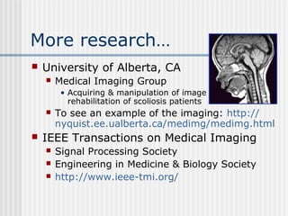 More research…
 University of Alberta, CA
 Medical Imaging Group
• Acquiring & manipulation of image data for
rehabilitation of scoliosis patients
 To see an example of the imaging: http://
nyquist.ee.ualberta.ca/medimg/medimg.html
 IEEE Transactions on Medical Imaging
 Signal Processing Society
 Engineering in Medicine & Biology Society
 http://www.ieee-tmi.org/
 