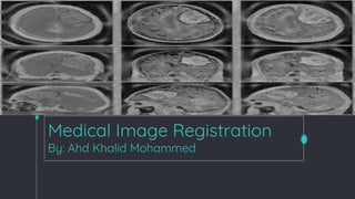 Medical Image Registration
By: Ahd Khalid Mohammed
 