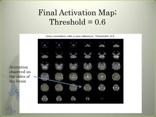 Final Activation Map; Threshold = 0.6 Activation observed on the sides of the brain 