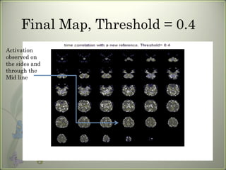 Final Map, Threshold = 0.4 Activation observed on the sides and through the Mid line 