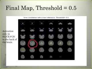Final Map, Threshold = 0.5 Activation only in SLICE # 20 in the back of the brain 