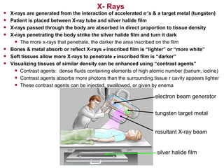 X- Rays
• X-rays are generated from the interaction of accelerated e-
’s & a target metal (tungsten)
• Patient is placed between X-ray tube and silver halide film
• X-rays passed through the body are absorbed in direct proportion to tissue density
• X-rays penetrating the body strike the silver halide film and turn it dark
• The more x-rays that penetrate, the darker the area inscribed on the film
• Bones & metal absorb or reflect X-rays rinscribed film is “lighter” or “more white”
• Soft tissues allow more X-rays to penetrate rinscribed film is “darker”
• Visualizing tissues of similar density can be enhanced using “contrast agents”
• Contrast agents: dense fluids containing elements of high atomic number (barium, iodine)
• Contrast agents absorbs more photons than the surrounding tissue r cavity appears lighter
• These contrast agents can be injected, swallowed, or given by enema
electron beam generator
tungsten target metal
resultant X-ray beam
silver halide film
 