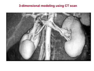 3-dimensional modeling using CT scan
 