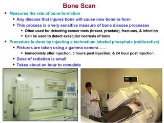 Bone Scan
• Measures the rate of bone formation
• Any disease that injures bone will cause new bone to form
• This process is a very sensitive measure of bone disease processes
• Often used for detecting cancer mets (breast, prostate), fractures, & infection
• Can be used to detect avascular necrosis of bone
• Procedure is done by injecting a technetium labeled phosphate (raidioactive)
• Pictures are taken using a gamma camera……
• Immediately after injection, 3 hours post injection, & 24 hour post injection
• Dose of radiation is small
• Takes about an hour to complete
 