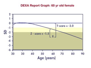 DEXA Report Graph: 60 yr old female
 