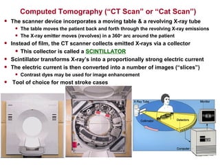 • The scanner device incorporates a moving table & a revolving X-ray tube
• The table moves the patient back and forth through the revolving X-ray emissions
• The X-ray emitter moves (revolves) in a 360o
arc around the patient
• Instead of film, the CT scanner collects emitted X-rays via a collector
• This collector is called a SCINTILLATOR
• Scintillator transforms X-ray’s into a proportionally strong electric current
• The electric current is then converted into a number of images (“slices”)
• Contrast dyes may be used for image enhancement
• Tool of choice for most stroke cases
Computed Tomography (“CT Scan” or “Cat Scan”)
 