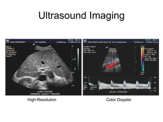 Medical imaging