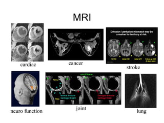 Medical imaging