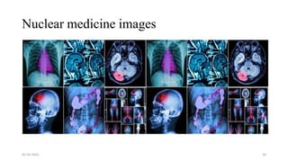 Nuclear medicine images
05-03-2023 20
 