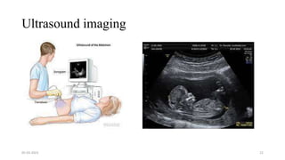 Ultrasound imaging
05-03-2023 22
 