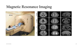 Magnetic Resonance Imaging
05-03-2023 24
 