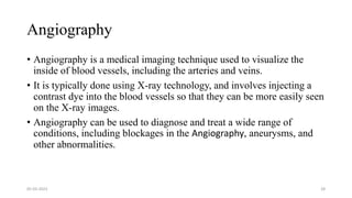 Angiography
• Angiography is a medical imaging technique used to visualize the
inside of blood vessels, including the arteries and veins.
• It is typically done using X-ray technology, and involves injecting a
contrast dye into the blood vessels so that they can be more easily seen
on the X-ray images.
• Angiography can be used to diagnose and treat a wide range of
conditions, including blockages in the Angiography, aneurysms, and
other abnormalities.
05-03-2023 28
 