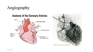 Angiography
05-03-2023 29
 