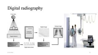 Digital radiography
05-03-2023 31
 