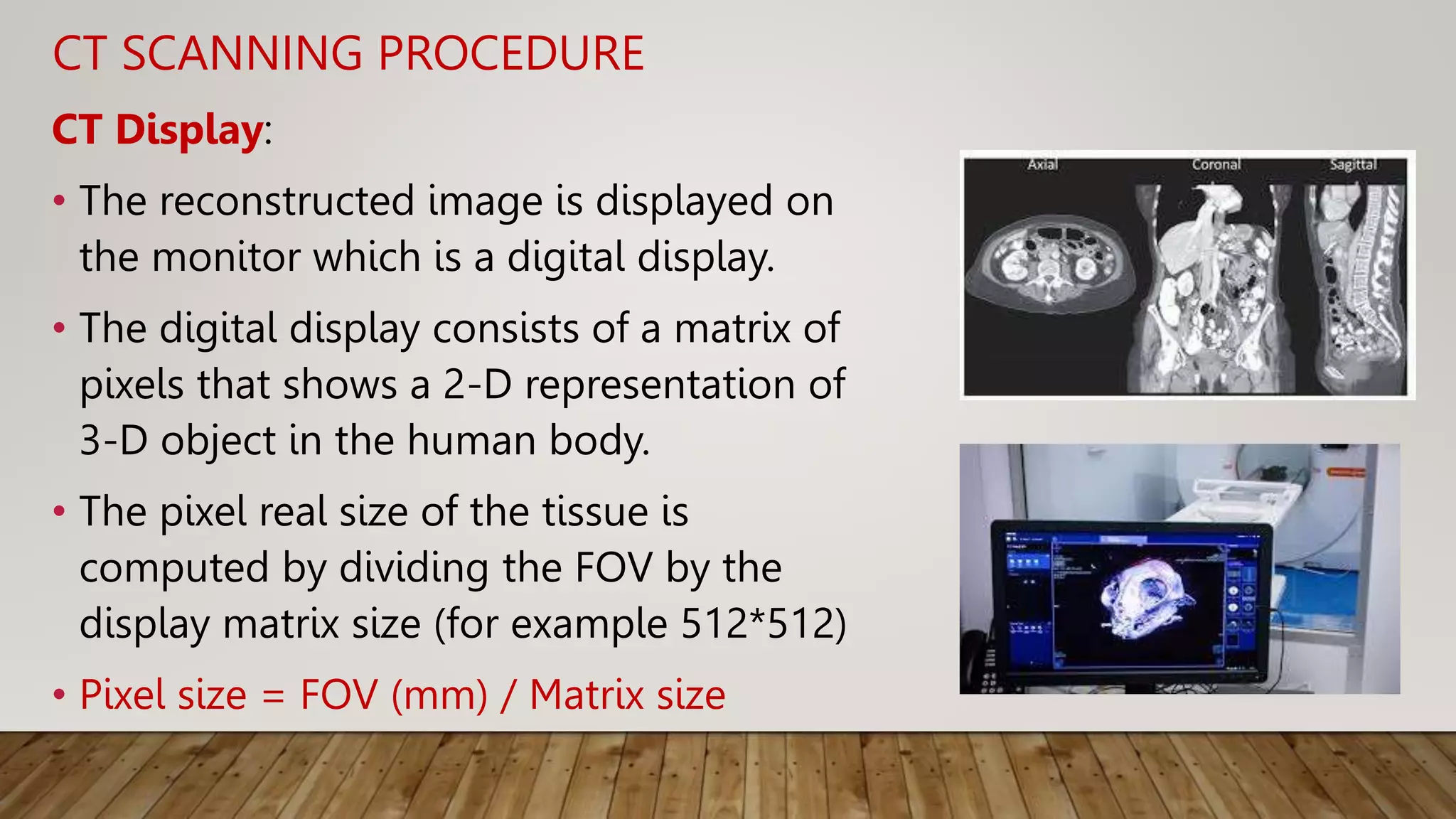 CT SCANNING PROCEDURE
CT Display:
• The reconstructed image is displayed on
the monitor which is a digital display.
• The digital display consists of a matrix of
pixels that shows a 2-D representation of
3-D object in the human body.
• The pixel real size of the tissue is
computed by dividing the FOV by the
display matrix size (for example 512*512)
• Pixel size = FOV (mm) / Matrix size
 