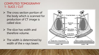 Computed Tomography | PPTX