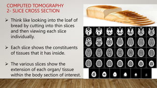 Computed Tomography | PPTX