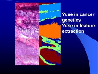 ?use in cancer
genetics
?use in feature
extraction
 
