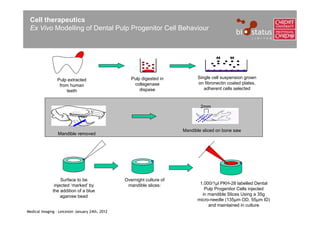 Cell therapeutics
 Ex Vivo Modelling of Dental Pulp Progenitor Cell Behaviour




                                                    Pulp digested in          Single cell suspension grown
                 Pulp extracted
                                                     collagenase              on fibronectin coated plates,
                  from human
                                                        dispase                  adherent cells selected
                     teeth


                                                                                2mm




                                                                        Mandible sliced on bone saw
                 Mandible removed




                   Surface to be                 Overnight culture of
               injected ‘marked’ by               mandible slices:             1,000/1μl PKH-28 labelled Dental
              the addition of a blue                                             Pulp Progenitor Cells injected
                   agarose bead                                                 in mandible Slices Using a 35g
                                                                              micro-needle (135μm OD, 55μm ID)
                                                                                   and maintained in culture
Medical Imaging – Leicester January 24th, 2012
 