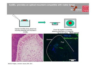 CyGEL: provides an optical mountant compatible with viable tissue




            Injected mandible slices placed into
                                                                Cover slip applied to assembly,
            mounting assembly and mounted in
                                                             allowing presentation of a relatively
                         CYGEL
                                                                      flat, level surface Sham Injected

                                                                               PKH 26
                                                                               Reflected Light
                                                   Dentine
                                                                          Pulp




Medical Imaging – Leicester January 24th, 2012
 