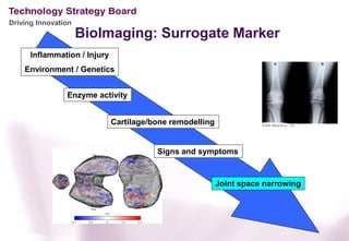 Driving Innovation
                     BioImaging: Surrogate Marker
      Inflammation / Injury
    Environment / Genetics


                Enzyme activity


                              Cartilage/bone remodelling


                                         Signs and symptoms



                                                           Joint space narrowing
 