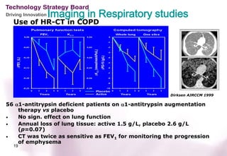 Driving Innovation   Imaging in Respiratory studies
   Use of HR-CT in COPD




                                                      Dirksen AJRCCM 1999

56 α1-antitrypsin deficient patients on α1-antitrypsin augmentation
    therapy vs placebo
•   No sign. effect on lung function
•   Annual loss of lung tissue: active 1.5 g/L, placebo 2.6 g/L
    (p=0.07)
•   CT was twice as sensitive as FEV1 for monitoring the progression
    of emphysema
   19
 