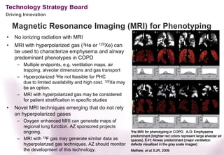 Driving Innovation

    Magnetic Resonance Imaging (MRI) for Phenotyping
•   No ionizing radiation with MRI
•   MRI with hyperpolarized gas (3He or 129Xe) can
    be used to characterize emphysema and airway
    predominant phenotypes in COPD
     – Multiple endpoints, e.g. ventilation maps, air
       trapping, alveolar dimensions and gas transport
     – Hyperpolarized 3He not feasible for PHC
       due to limited availability and high cost. 129Xe may
       be an option.
     – MRI with hyperpolarized gas may be considered
       for patient stratification in specific studies
•   Novel MRI techniques emerging that do not rely
    on hyperpolarized gases
     – Oxygen enhanced MRI can generate maps of
       regional lung function. AZ sponsored projects
                                                              3He MRI for phenotyping in COPD. A-D: Emphysema
       ongoing.
                                                              predominant (brighter red colors represent large alveolar air
     – MRI with 19F gas may generate similar data as          spaces). E-H: Airway predominant (major ventilation
       hyperpolarized gas techniques. AZ should monitor       defects visualized in the gray scale images)
       the development of this technology.                    Mathew, et al, EJR, 2009
 