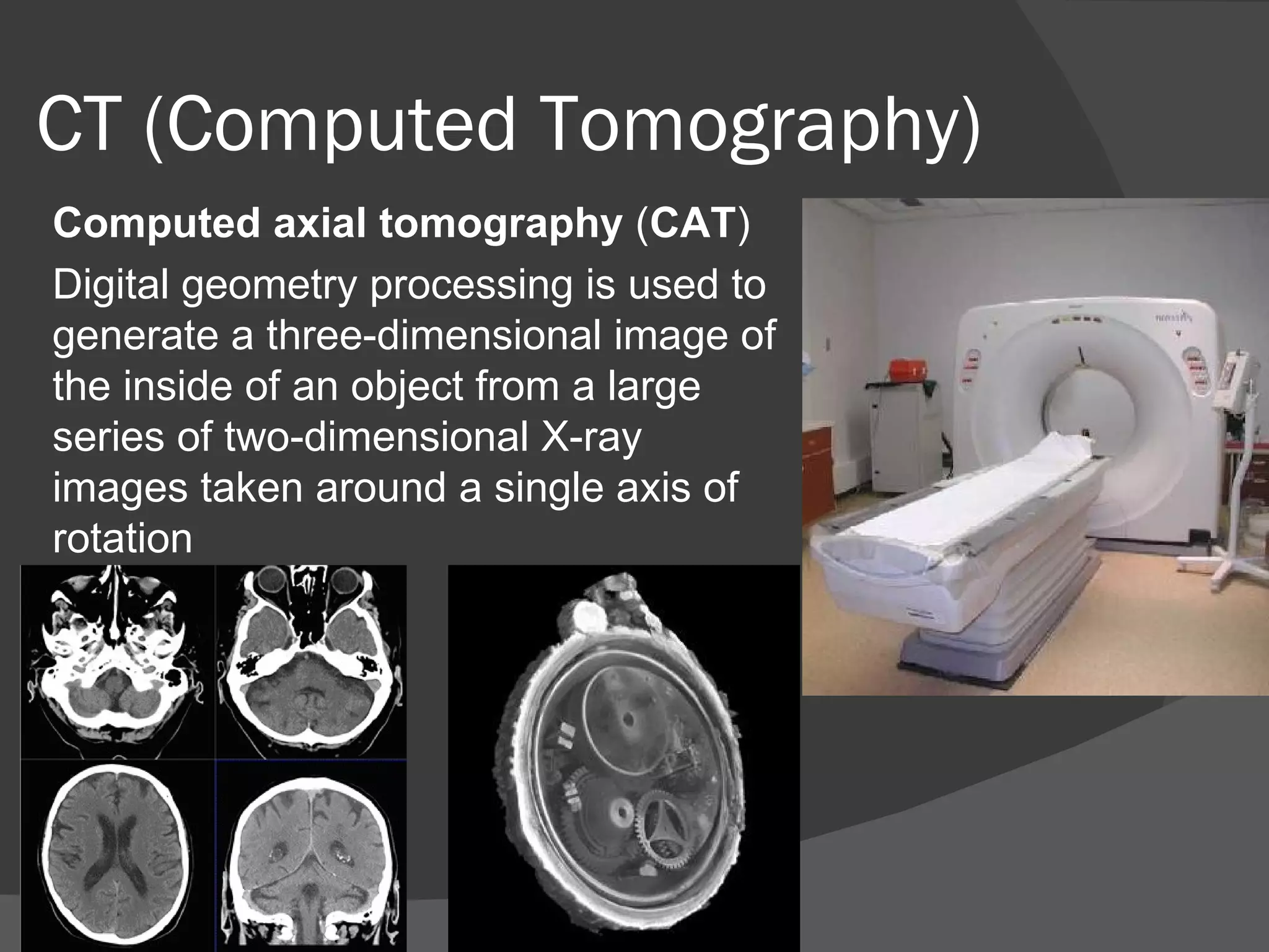 CT (Computed Tomography)
Computed axial tomography (CAT)
Digital geometry processing is used to
generate a three-dimensional image of
the inside of an object from a large
series of two-dimensional X-ray
images taken around a single axis of
rotation
 