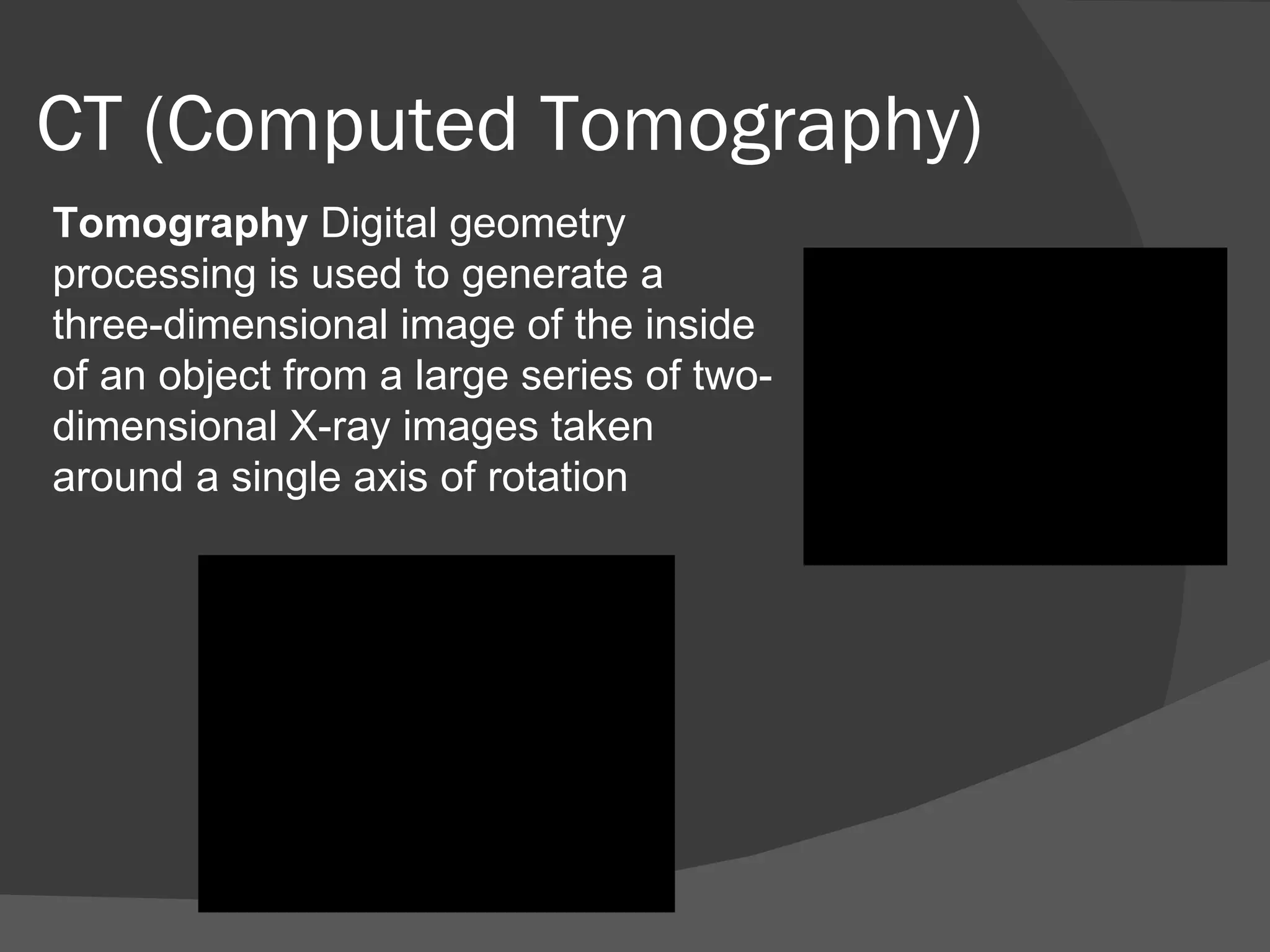 CT (Computed Tomography)
Tomography Digital geometry
processing is used to generate a
three-dimensional image of the inside
of an object from a large series of two-
dimensional X-ray images taken
around a single axis of rotation
 
