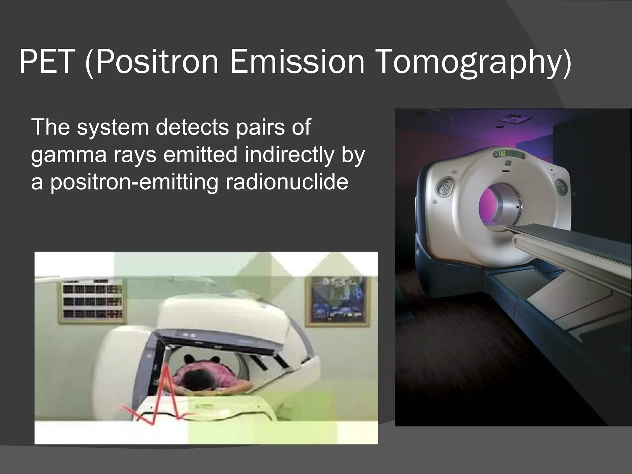 PET (Positron Emission Tomography)
The system detects pairs of
gamma rays emitted indirectly by
a positron-emitting radionuclide
 