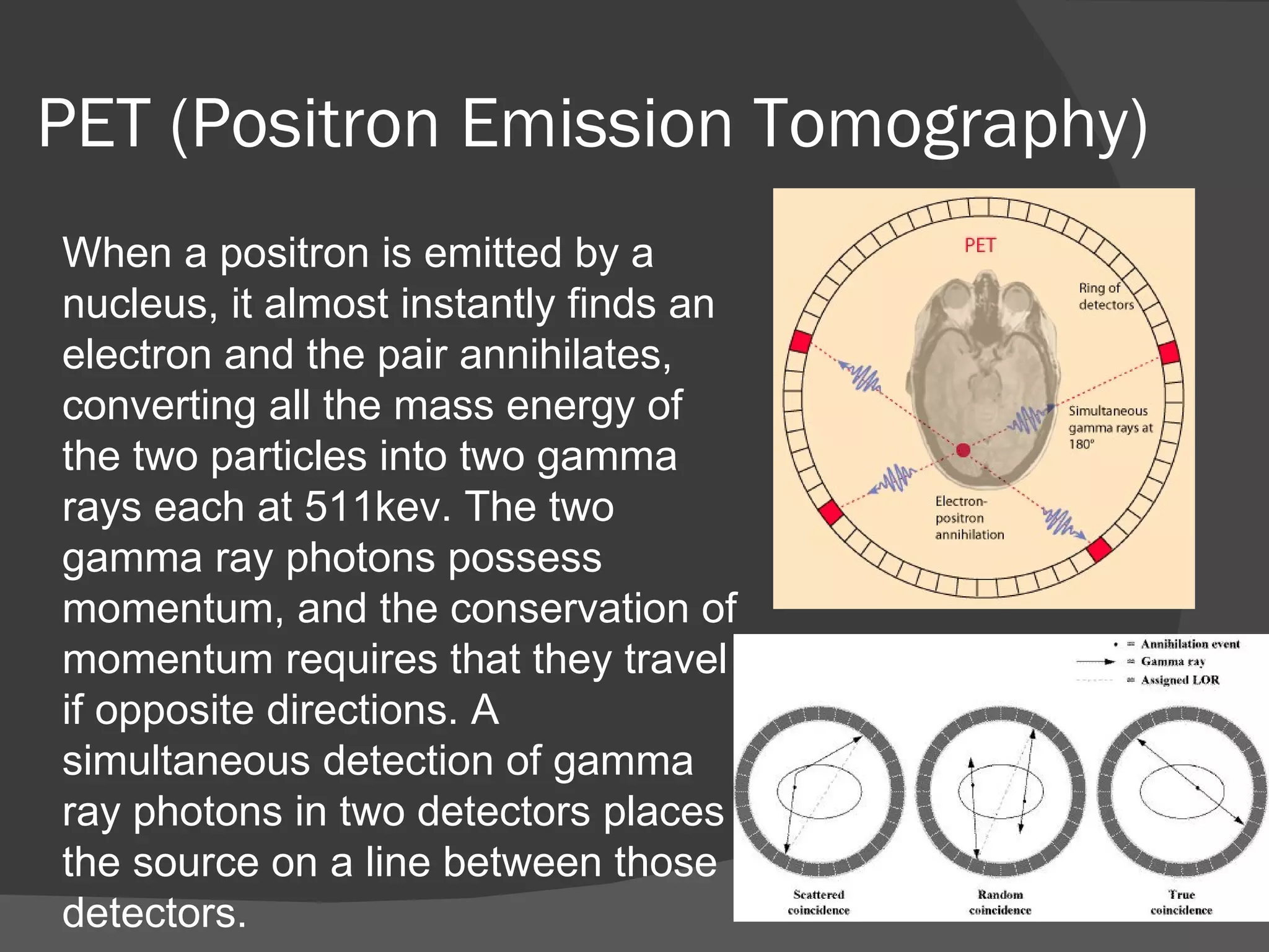 PET (Positron Emission Tomography)
When a positron is emitted by a
nucleus, it almost instantly finds an
electron and the pair annihilates,
converting all the mass energy of
the two particles into two gamma
rays each at 511kev. The two
gamma ray photons possess
momentum, and the conservation of
momentum requires that they travel
if opposite directions. A
simultaneous detection of gamma
ray photons in two detectors places
the source on a line between those
detectors.
 