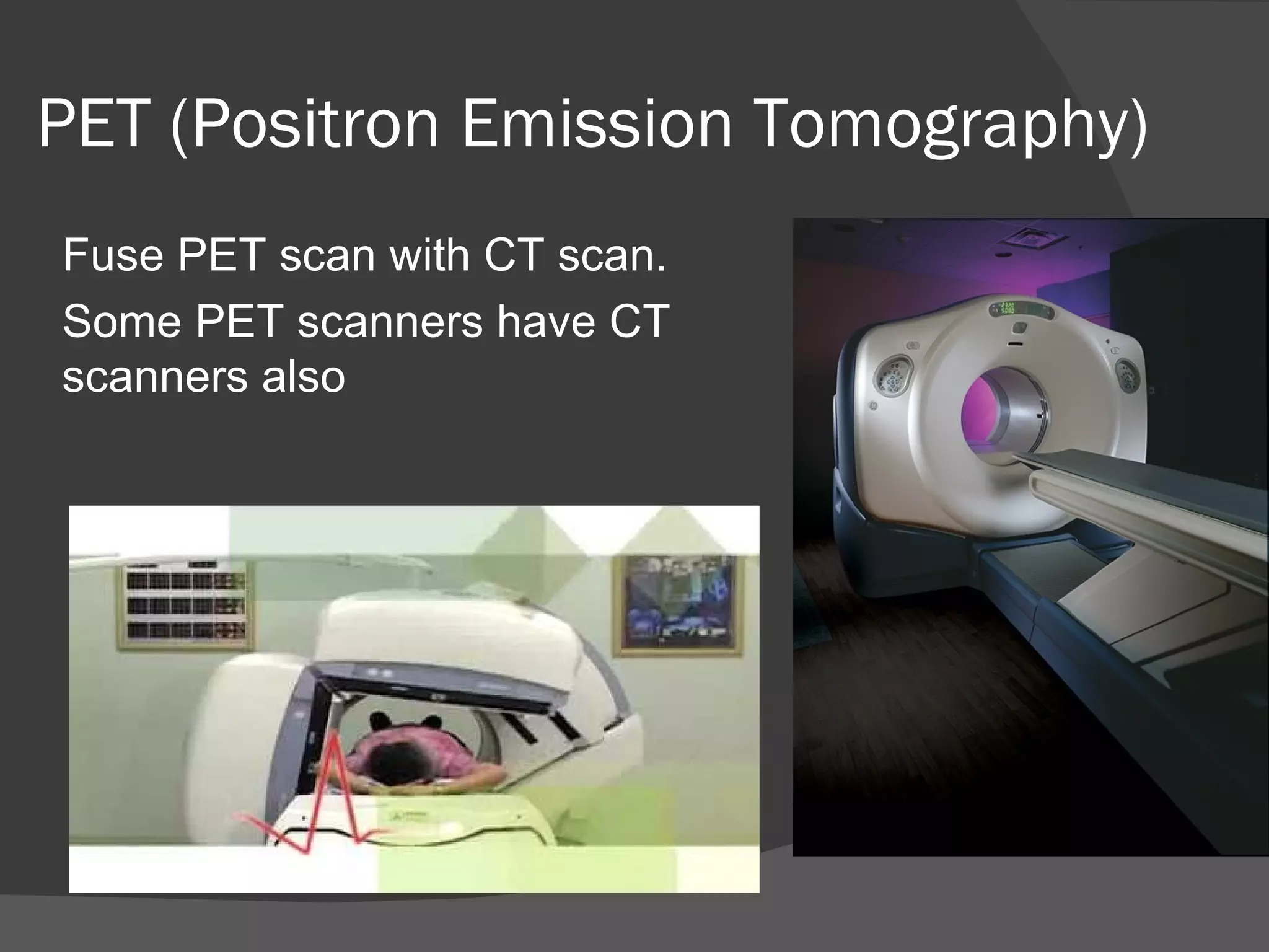 PET (Positron Emission Tomography)
Fuse PET scan with CT scan.
Some PET scanners have CT
scanners also
 