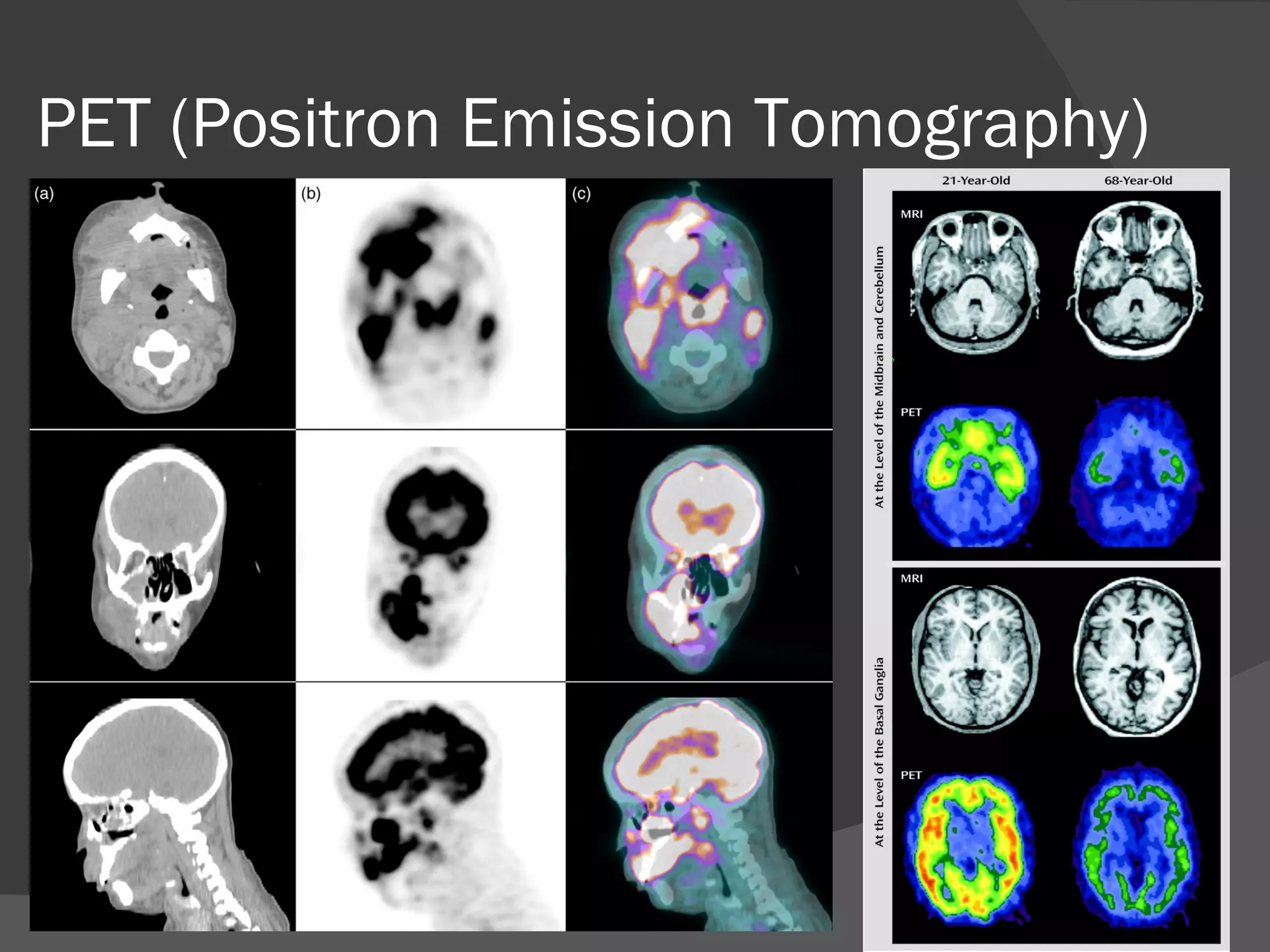PET (Positron Emission Tomography)
 