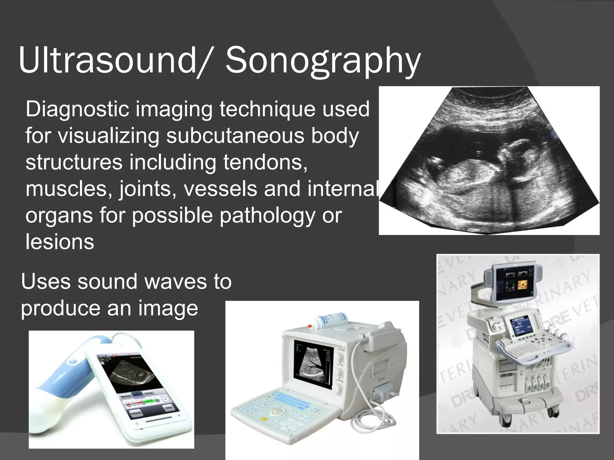 Ultrasound/ Sonography
Diagnostic imaging technique used
for visualizing subcutaneous body
structures including tendons,
muscles, joints, vessels and internal
organs for possible pathology or
lesions
Uses sound waves to
produce an image
 