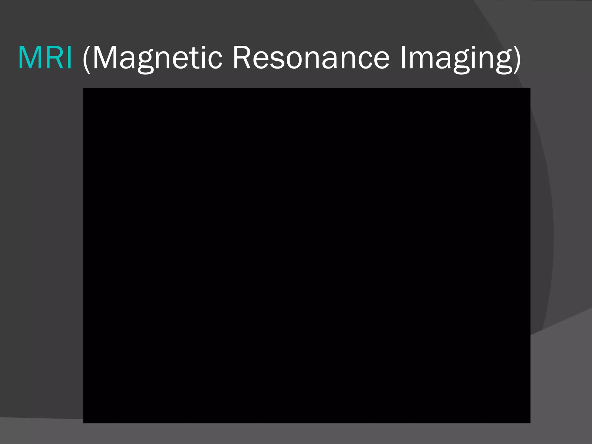 MRI (Magnetic Resonance Imaging)
 