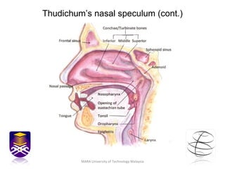 Thudichum’s nasal speculum (cont.) MARA University of Technology Malaysia 