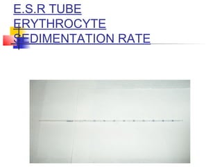 E.S.R TUBE
ERYTHROCYTE
SEDIMENTATION RATE
 
