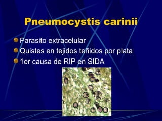 Pneumocystis carinii Parasito extracelular Quistes en tejidos teñidos por plata 1er causa de RIP en SIDA 