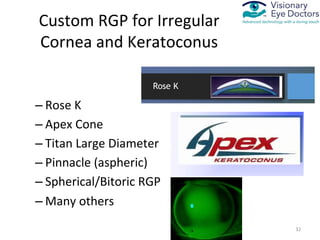 Medically Necessary Contact Lenses for Irregular Cornea | PDF