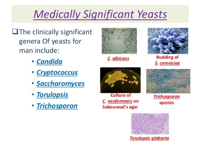 Medically Significant Yeasts medically-significant-yeasts