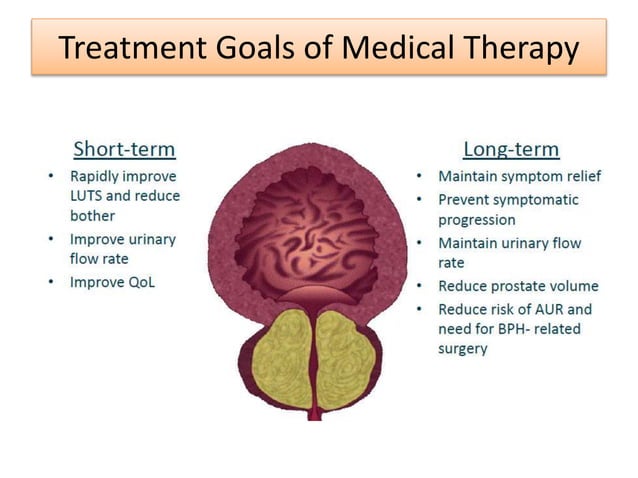 Medical management of bph | PPTX | Physical Therapy | Wellness