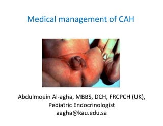 Medical management of CAH
Abdulmoein Al-agha, MBBS, DCH, FRCPCH (UK),
Pediatric Endocrinologist
aagha@kau.edu.sa
 