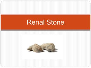 Renal Stone
 