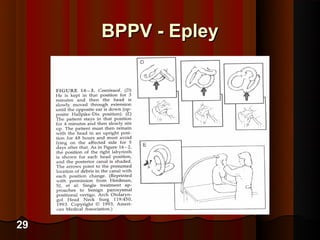 Medical management of vestibular disorders and vestibular ...