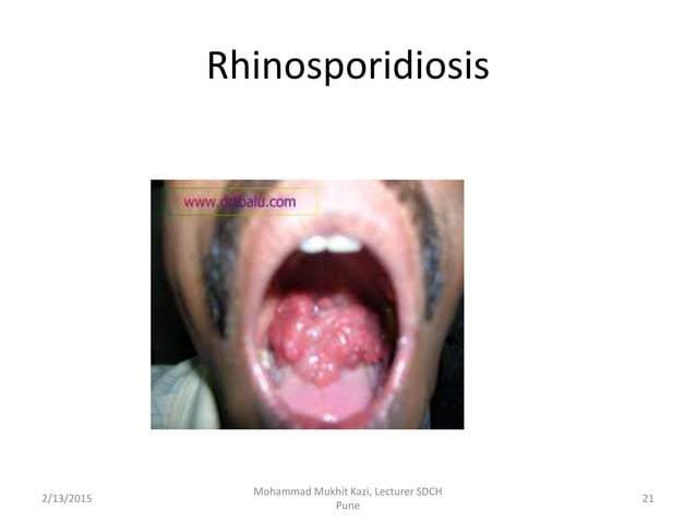 medical-mycology-ppt
