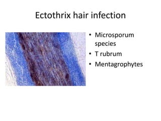 Medical mycology 2 | PPTX