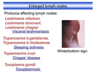 Winterbutton Sign 1. medical parasitic conditions ppt.pptx