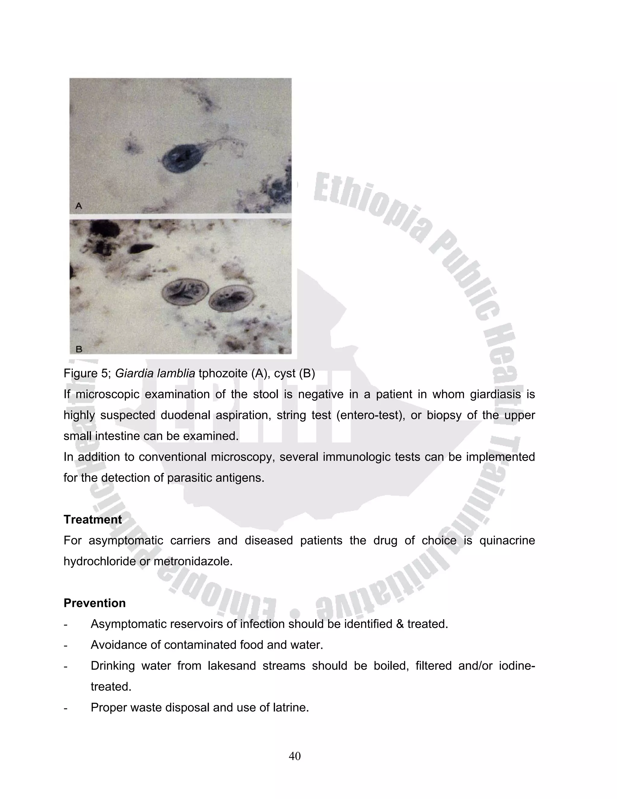 Figure 5; Giardia lamblia tphozoite (A), cyst (B)
If microscopic examination of the stool is negative in a patient in whom giardiasis is
highly suspected duodenal aspiration, string test (entero-test), or biopsy of the upper
small intestine can be examined.
In addition to conventional microscopy, several immunologic tests can be implemented
for the detection of parasitic antigens.


Treatment
For asymptomatic carriers and diseased patients the drug of choice is quinacrine
hydrochloride or metronidazole.


Prevention
-    Asymptomatic reservoirs of infection should be identified & treated.
-    Avoidance of contaminated food and water.
-    Drinking water from lakesand streams should be boiled, filtered and/or iodine-
     treated.
-    Proper waste disposal and use of latrine.



                                           40
 